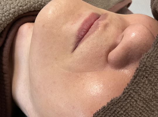 脱毛が終わった頃には‼️