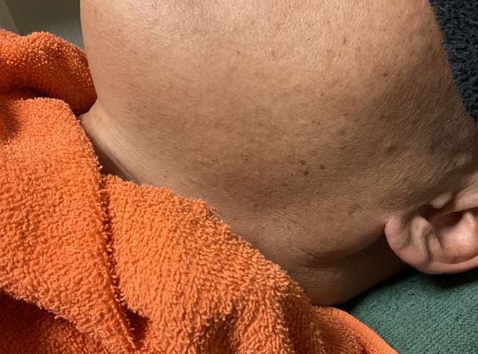 脱毛効果の出方が人気の秘密‼️