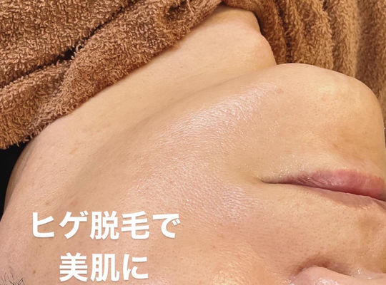 光といっても様々‼️