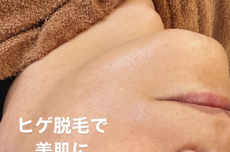 光といっても様々‼️