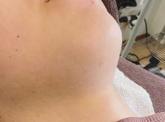 脱毛サロンの効果は様々‼️