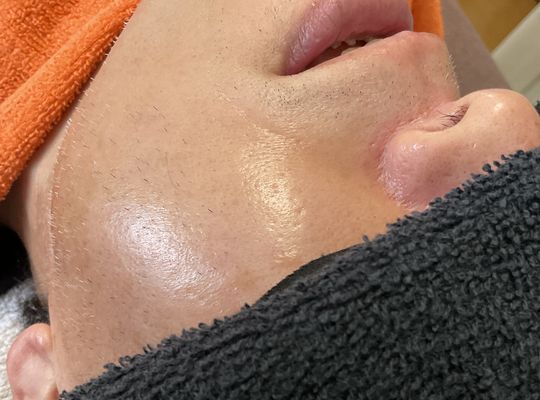 脱毛は若くから始めると効果が早い‼️