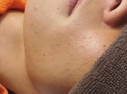 これから脱毛されたい方に‼️