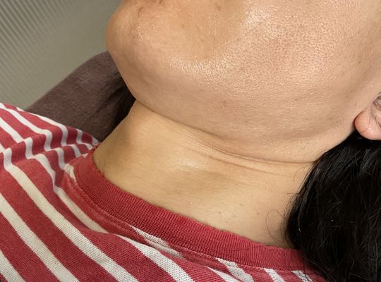 肌は毎日の手入れで劇的に変わる‼️