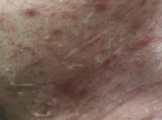 ヒゲは絶対に抜いてはいけない‼️